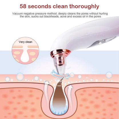 Visible Camera Blackhead Remover Vacuum Suction